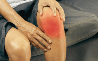 Minor Injury After a Car Accident: Do you need a lawyer?