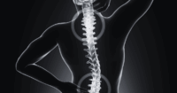 eligible for workers’ compensation